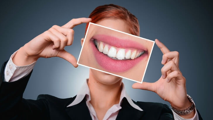 歯のホワイトニング方法は3種類ある